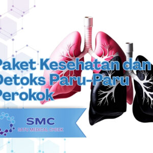Paket Kesehatan dan Detoks Paru-Paru Perokok